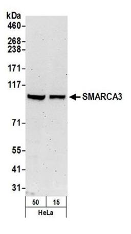 Detection of human SMARCA3 by western blot.