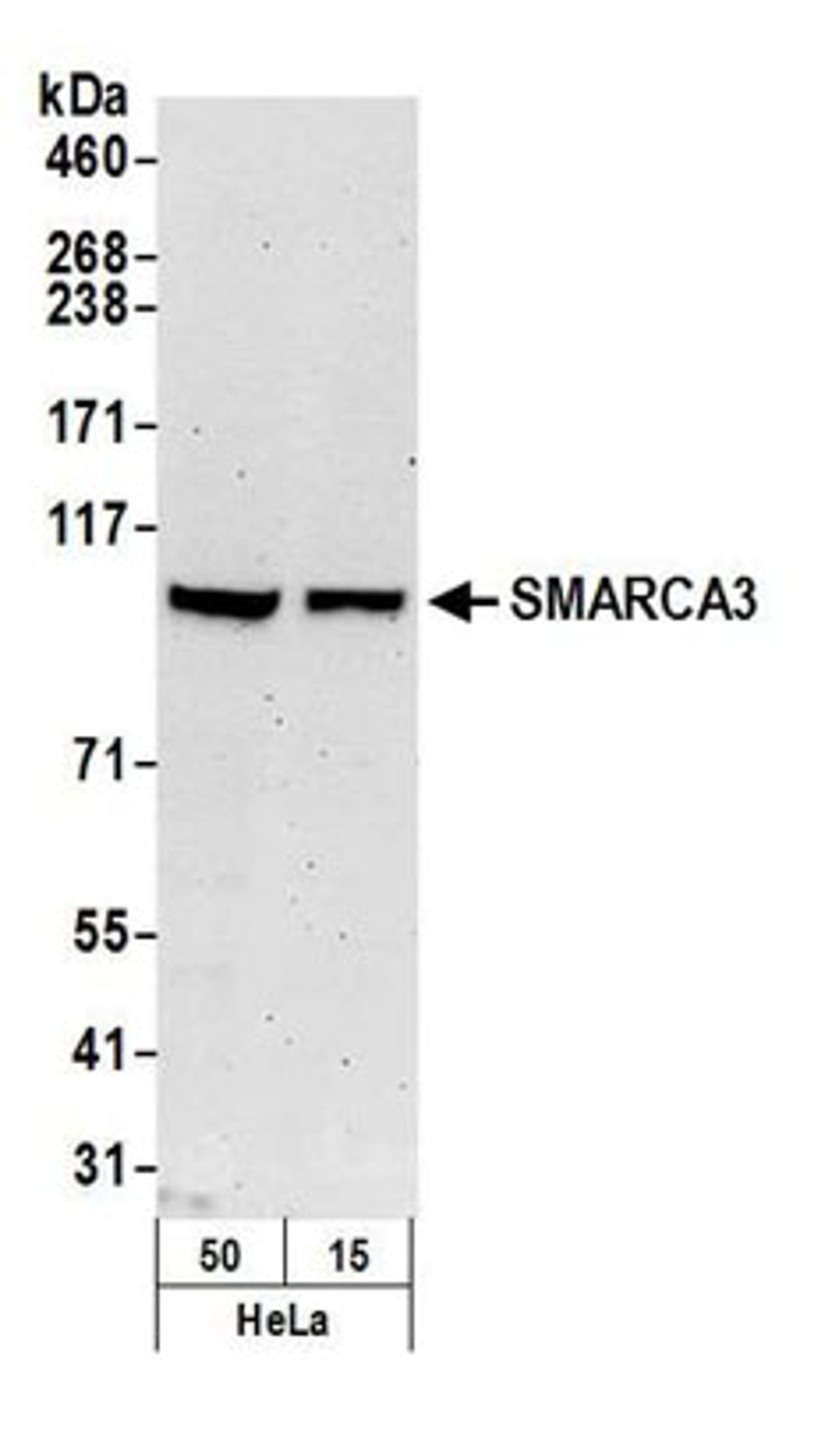 Detection of human SMARCA3 by western blot.