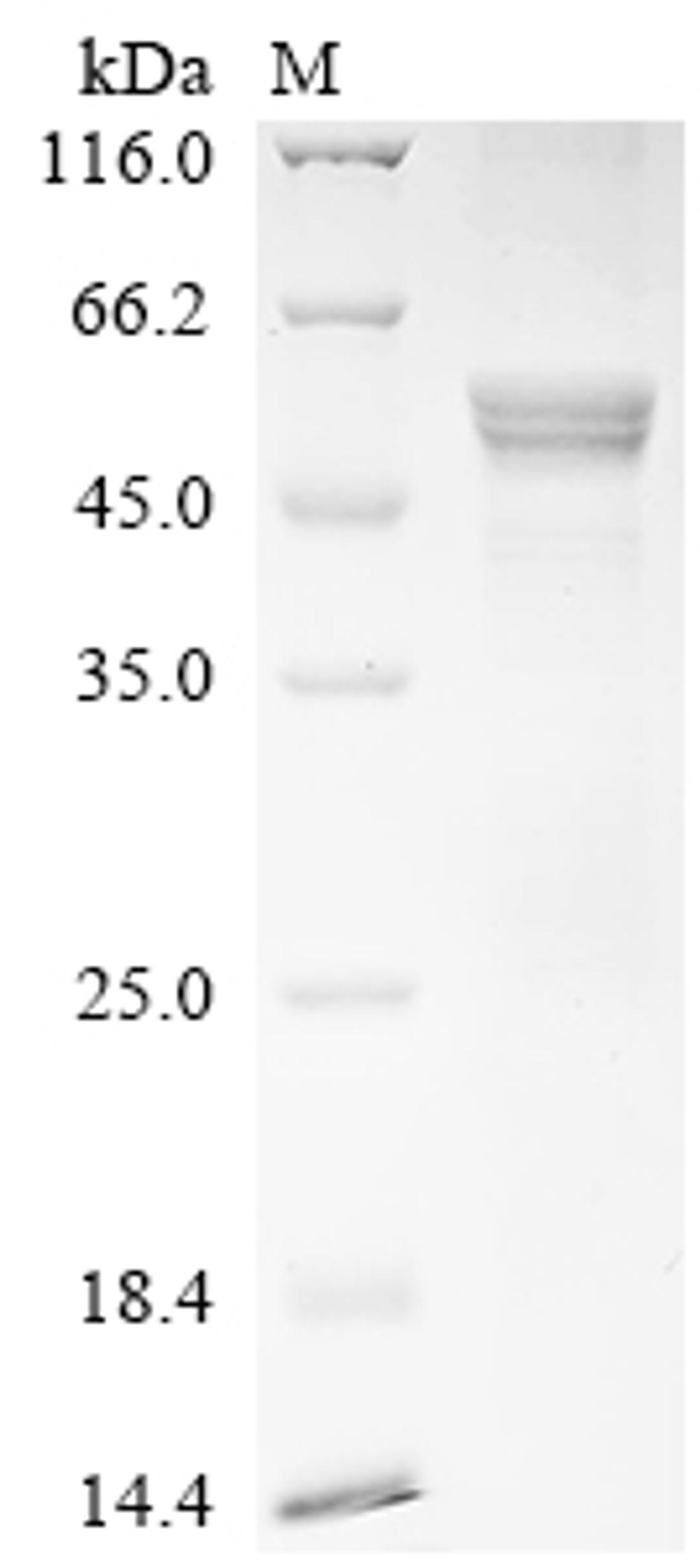 (Tris-Glycine gel) Discontinuous SDS-PAGE (reduced) with 5% enrichment gel and 15% separation gel.