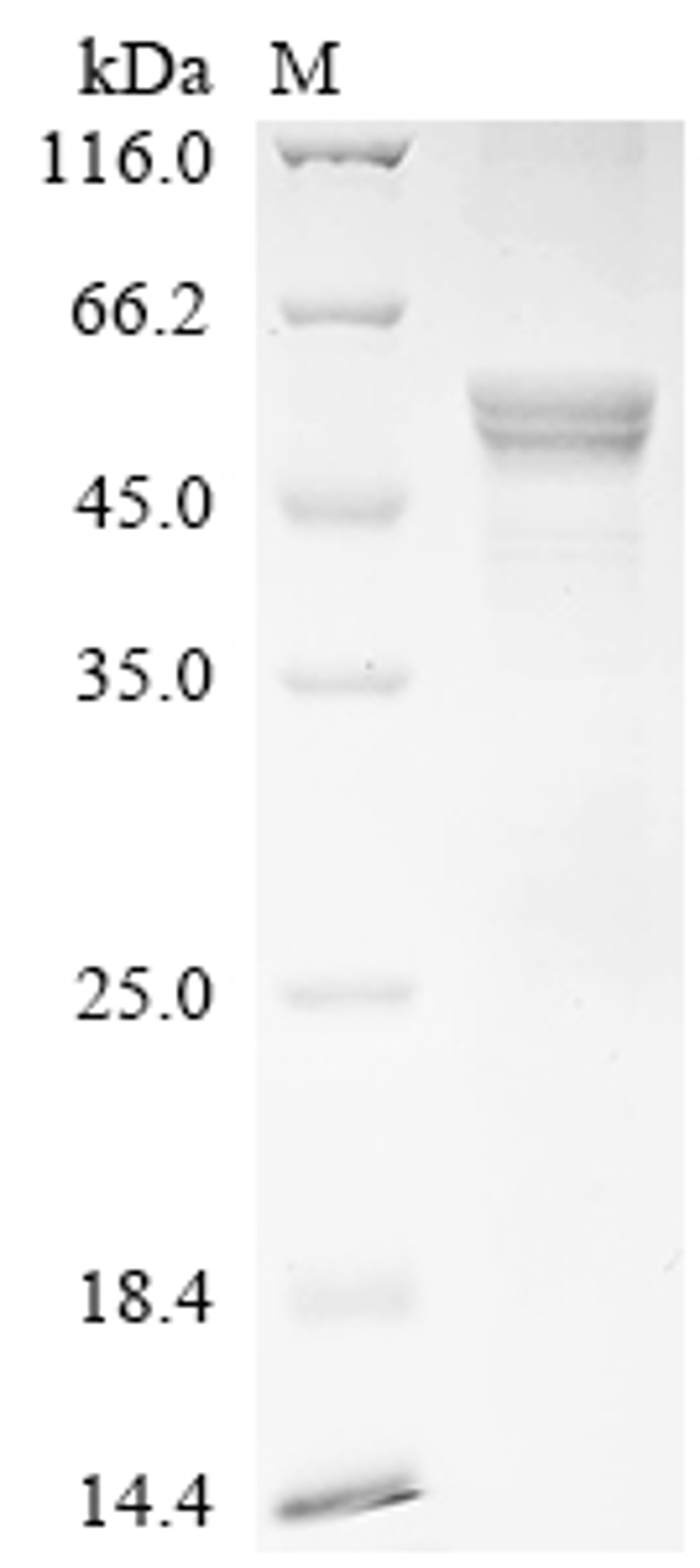 (Tris-Glycine gel) Discontinuous SDS-PAGE (reduced) with 5% enrichment gel and 15% separation gel.