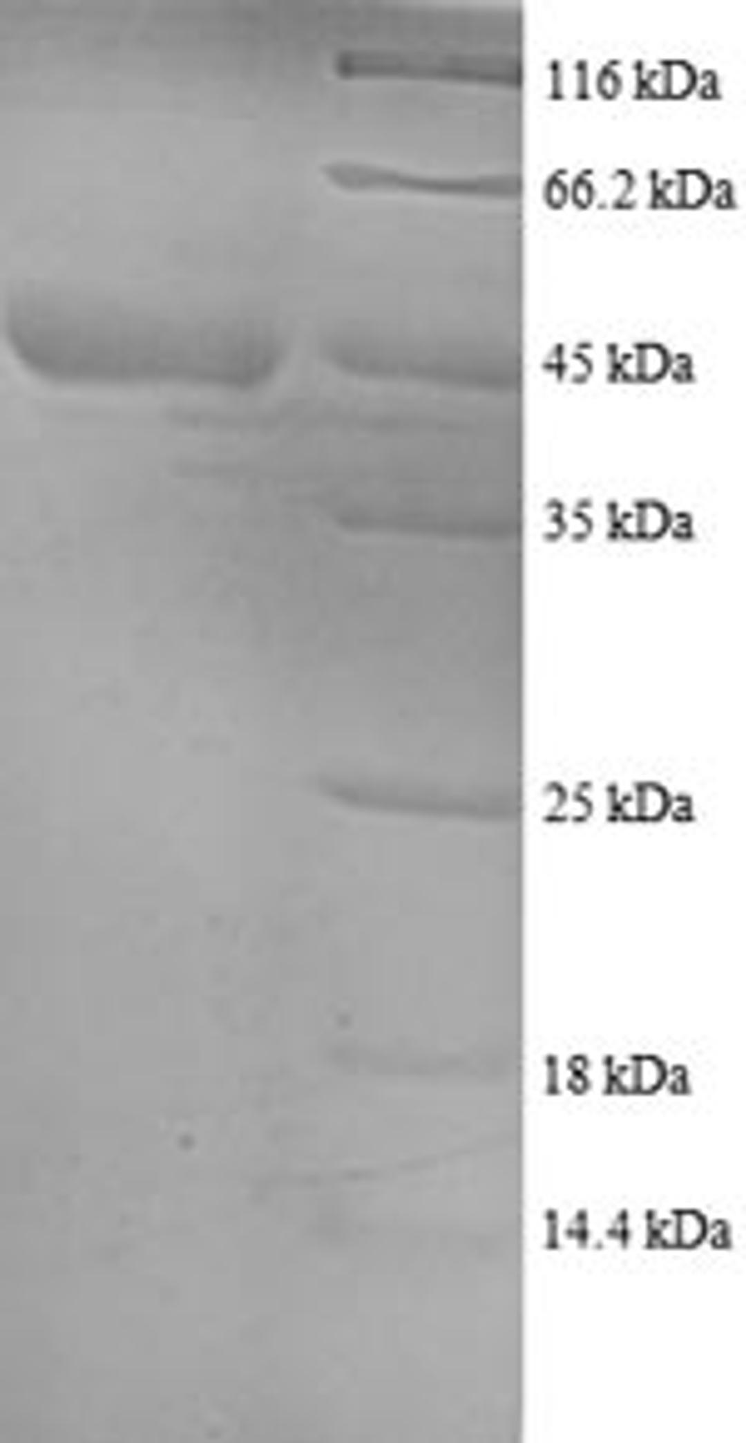 (Tris-Glycine gel) Discontinuous SDS-PAGE (reduced) with 5% enrichment gel and 15% separation gel.