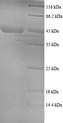 (Tris-Glycine gel) Discontinuous SDS-PAGE (reduced) with 5% enrichment gel and 15% separation gel.