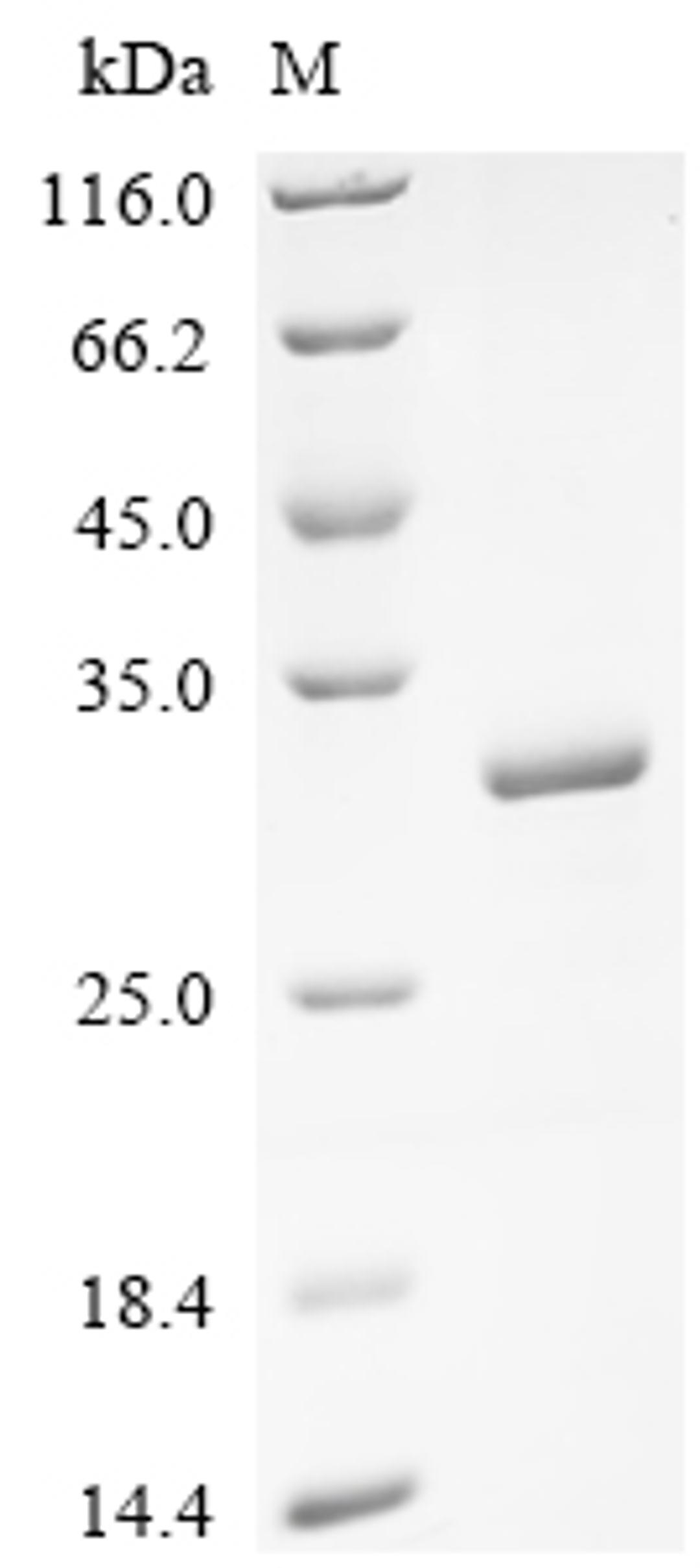 (Tris-Glycine gel) Discontinuous SDS-PAGE (reduced) with 5% enrichment gel and 15% separation gel.