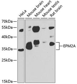 Western blot - EPM2A antibody (A7007)