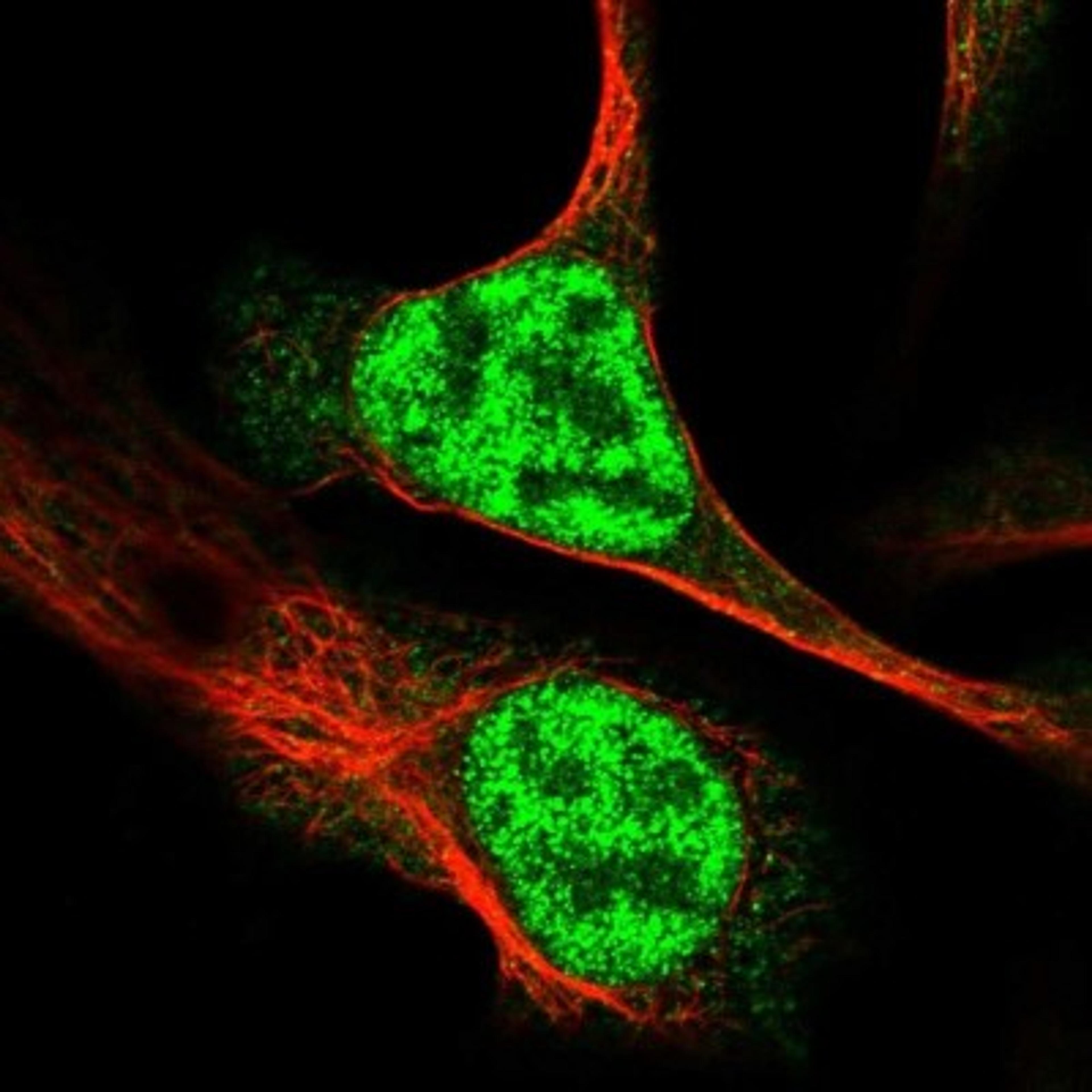 Immunocytochemistry/Immunofluorescence: RAD54L Antibody [NBP2-33916] - Immunofluorescent staining of human cell line U-2 OS shows positivity in nucleus but not nucleoli.