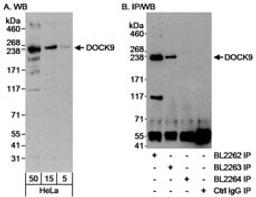 Detection of human DOCK9 by western blot and immunoprecipitation.