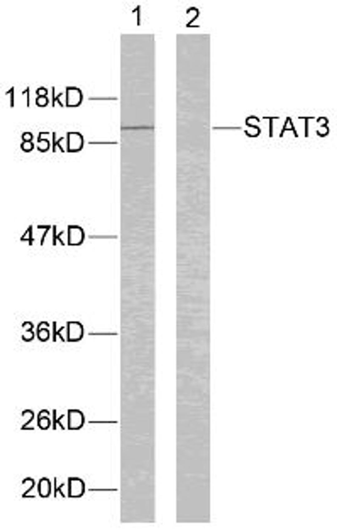 Western blot analysis of lysed extracts from HeLa cells using STAT3 (Ab-705).