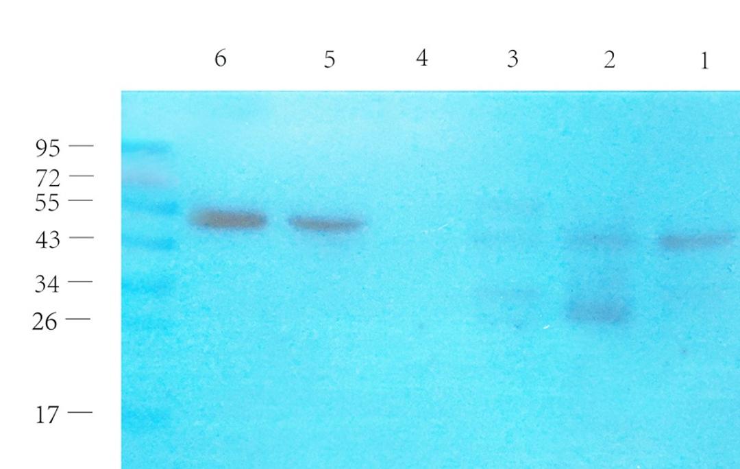 Western blot analysis of mouse liver (lane 1), mouse spleen (lane 2), rat kidney (lane 3), mouse thymus (lane 4), human breast cancer (lane 5), human lung cancer (lane 6) using FPR1 antibody (1 ug/ml)