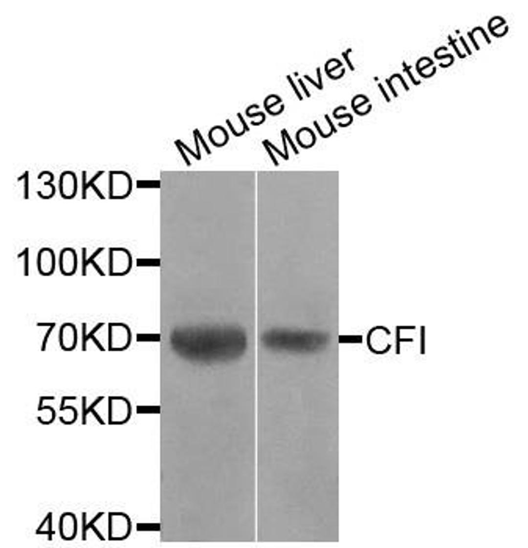 Western blot analysis of extracts of various cells using CFI antibody