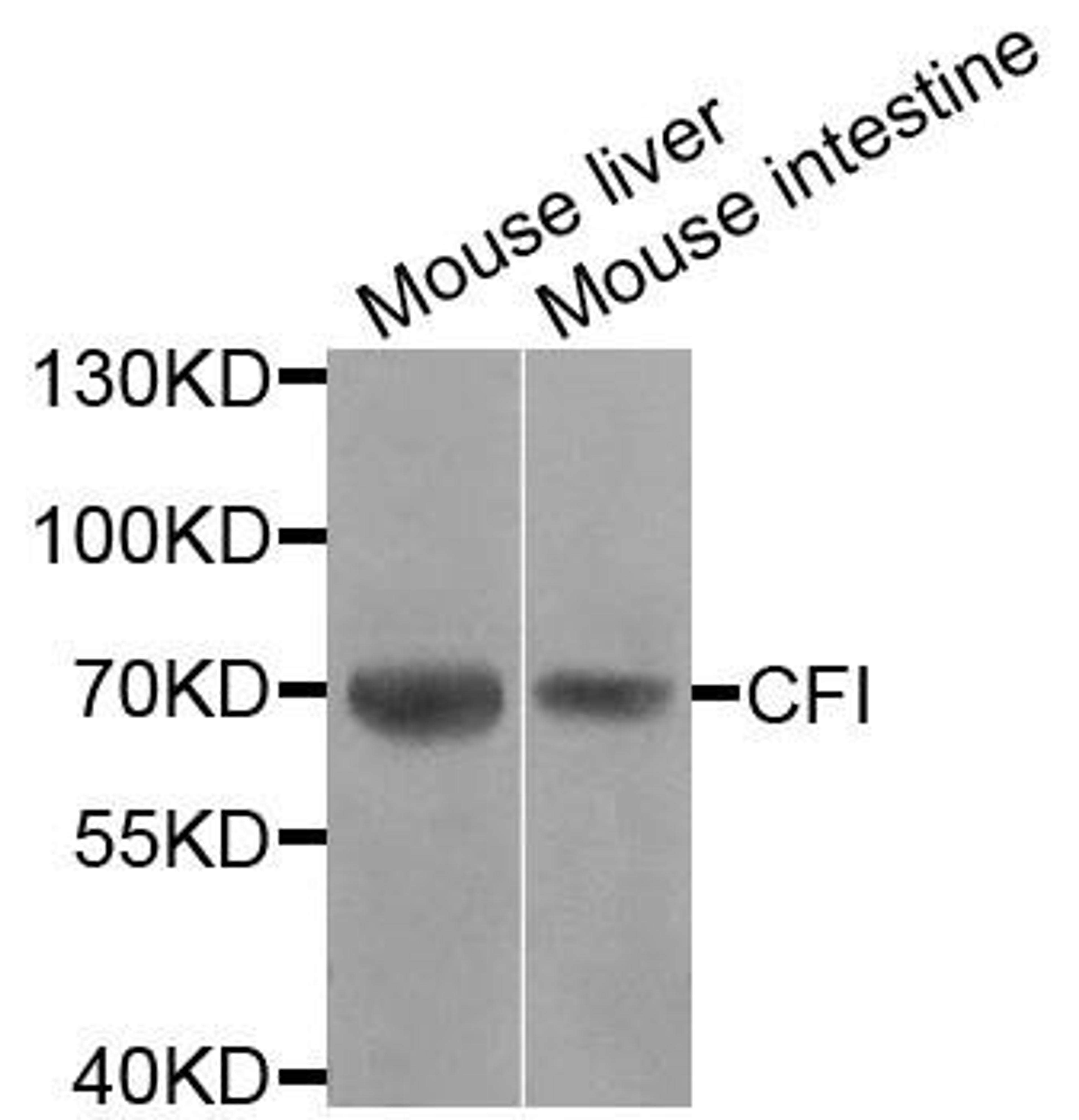 Western blot analysis of extracts of various cells using CFI antibody