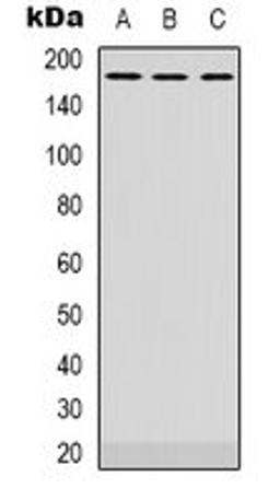 Western blot analysis of Hela (Lane 1), NIH3T3 (Lane 2), rat brain (Lane 3) whole cell lysates using ATP7A antibody