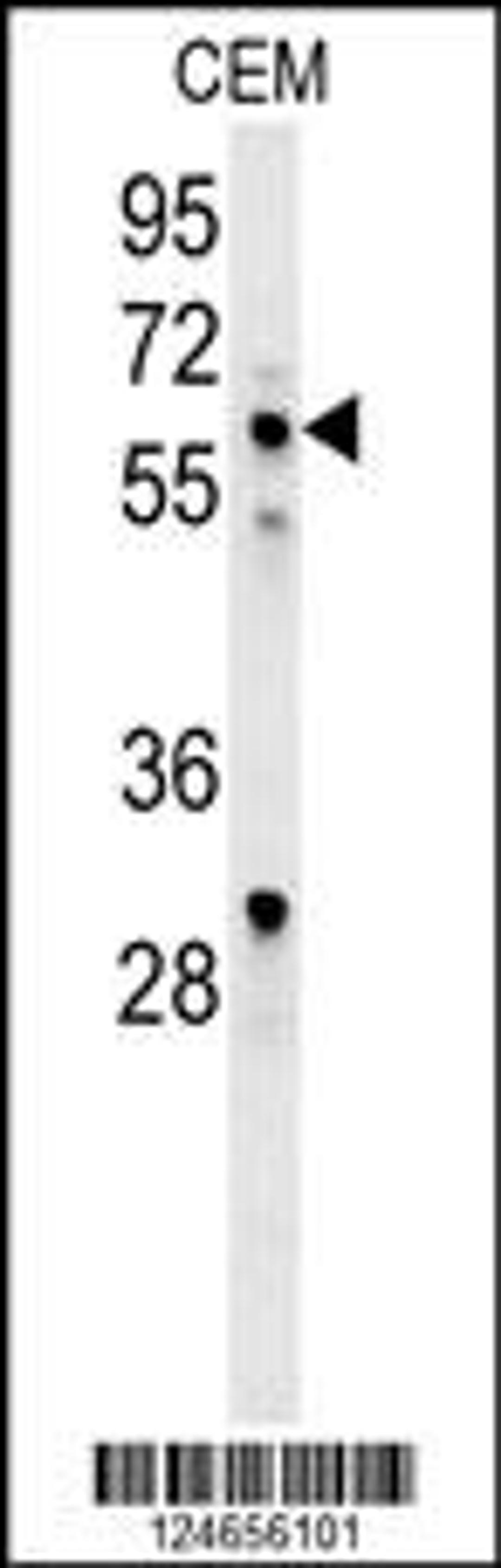 Western blot analysis in CEM cell line lysates (35ug/lane).