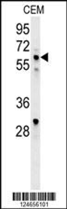 Western blot analysis in CEM cell line lysates (35ug/lane).