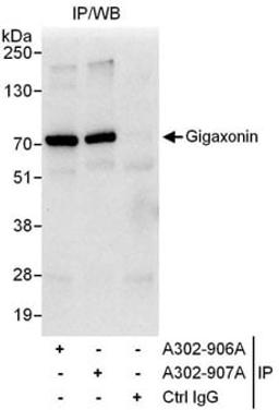 Detection of human Gigaxonin by western blot of immunoprecipitates.