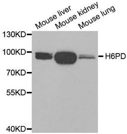 Western blot analysis of extracts of various tissues using H6PD antibody