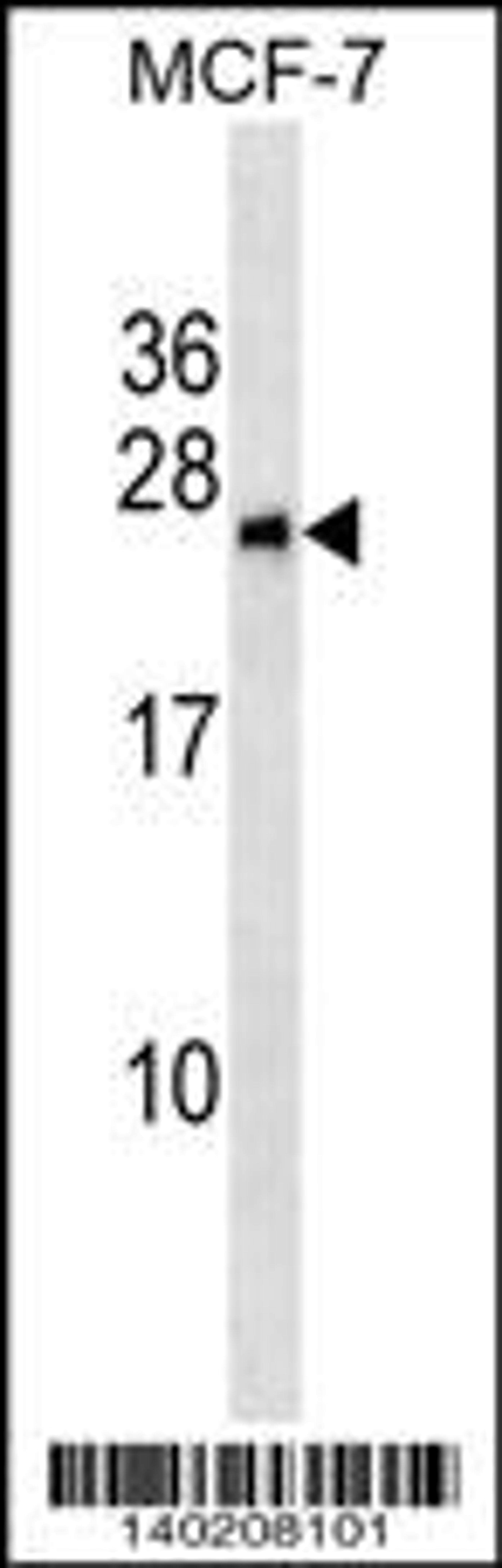 Western blot analysis in MCF-7 cell line lysates (35ug/lane).