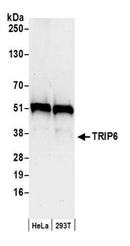 Detection of human TRIP6 by western blot.