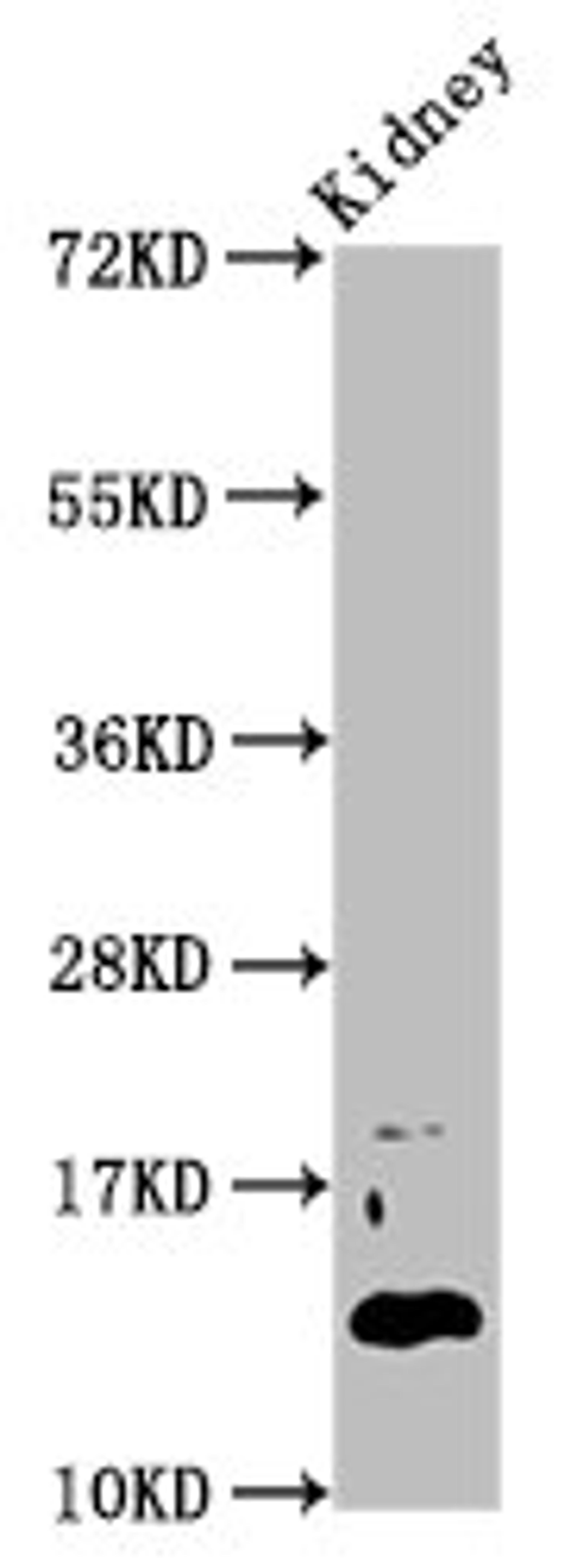 Western Blot. Positive WB detected in: Mouse kidney tissue. All lanes: DPPA5 antibody at 4.6ug/ml. Secondary. Goat polyclonal to rabbit IgG at 1/50000 dilution. Predicted band size: 14 kDa. Observed band size: 14 kDa. 