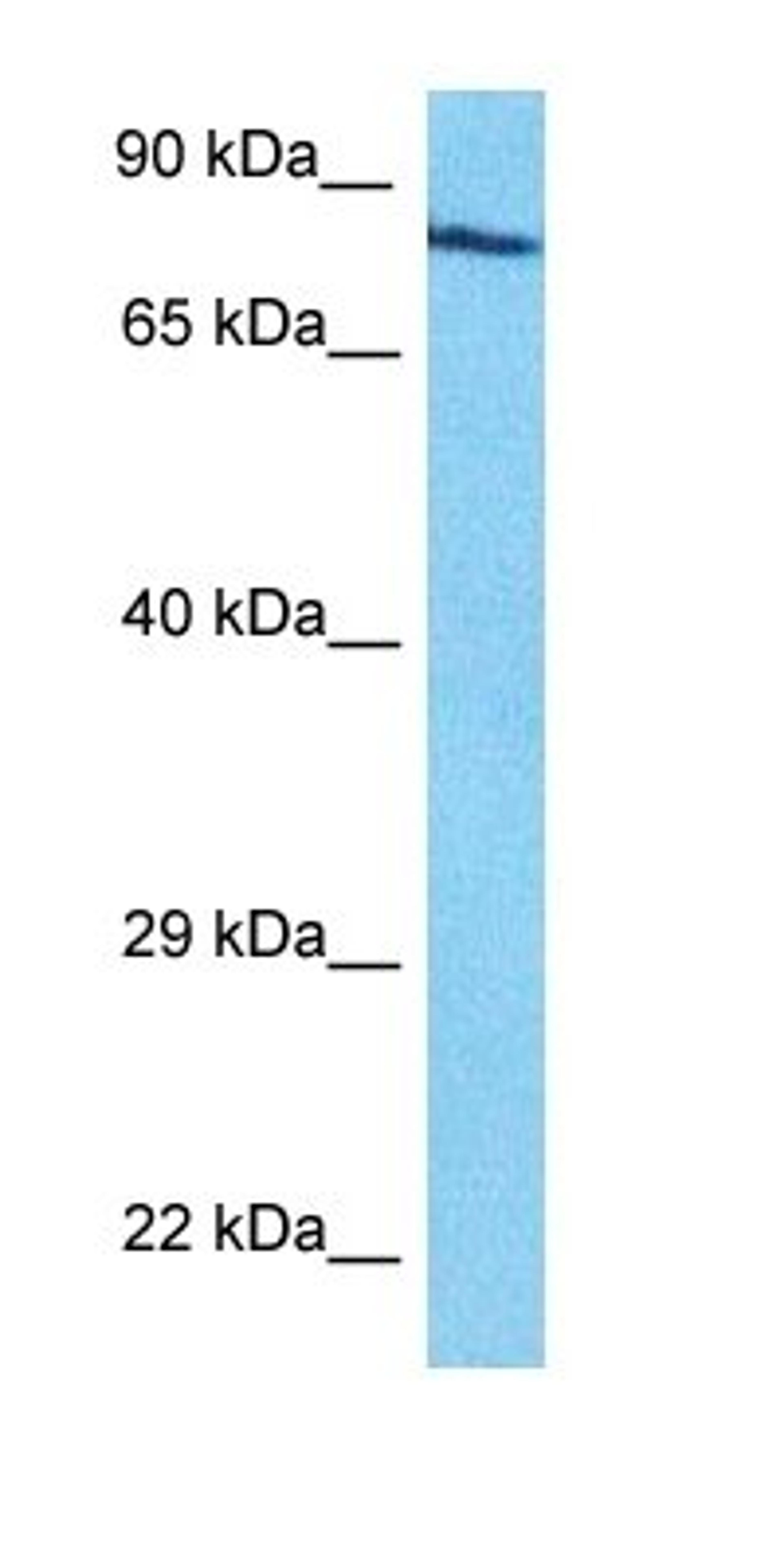 Western blot analysis of human Jurkat Whole Cell tissue using CFAB antibody