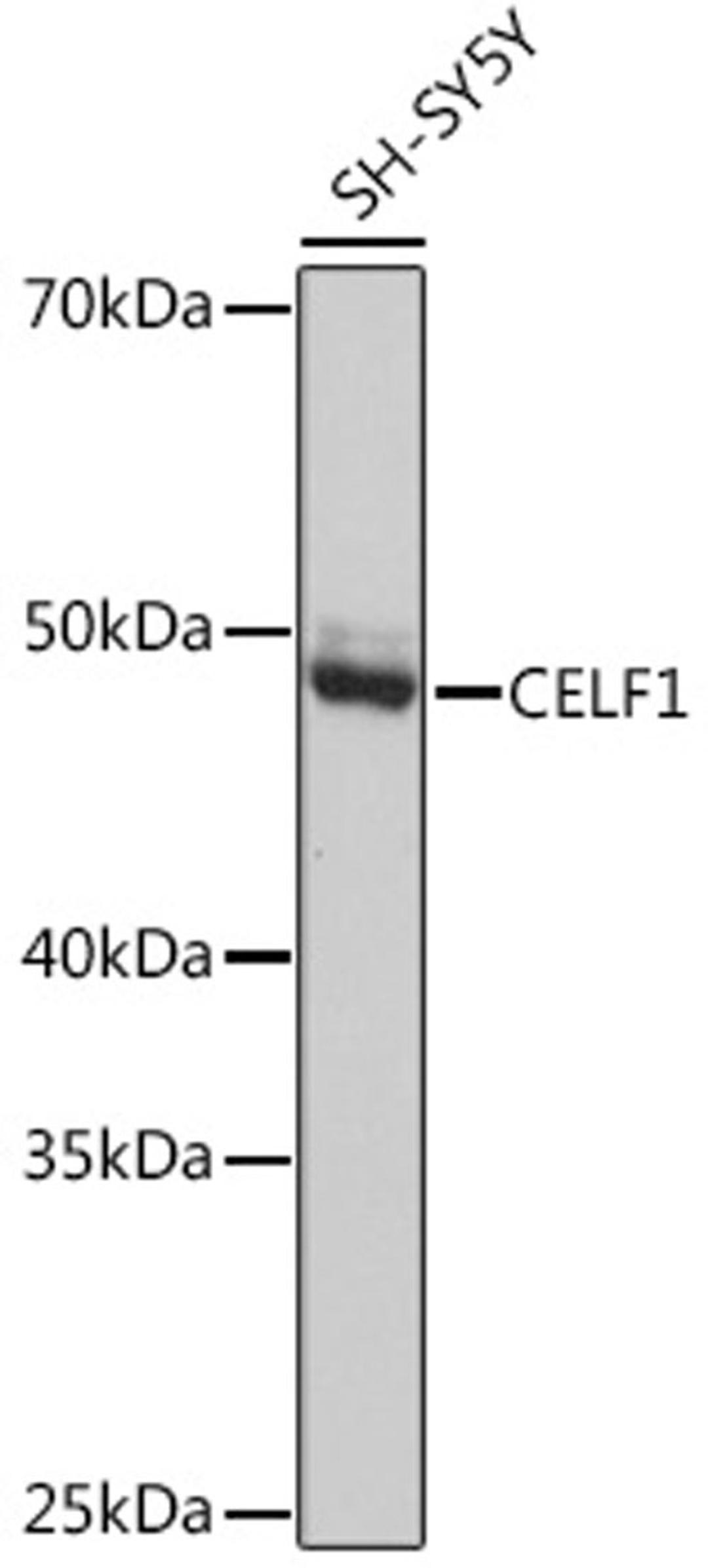 Western blot - CELF1 Rabbit mAb (A1150)