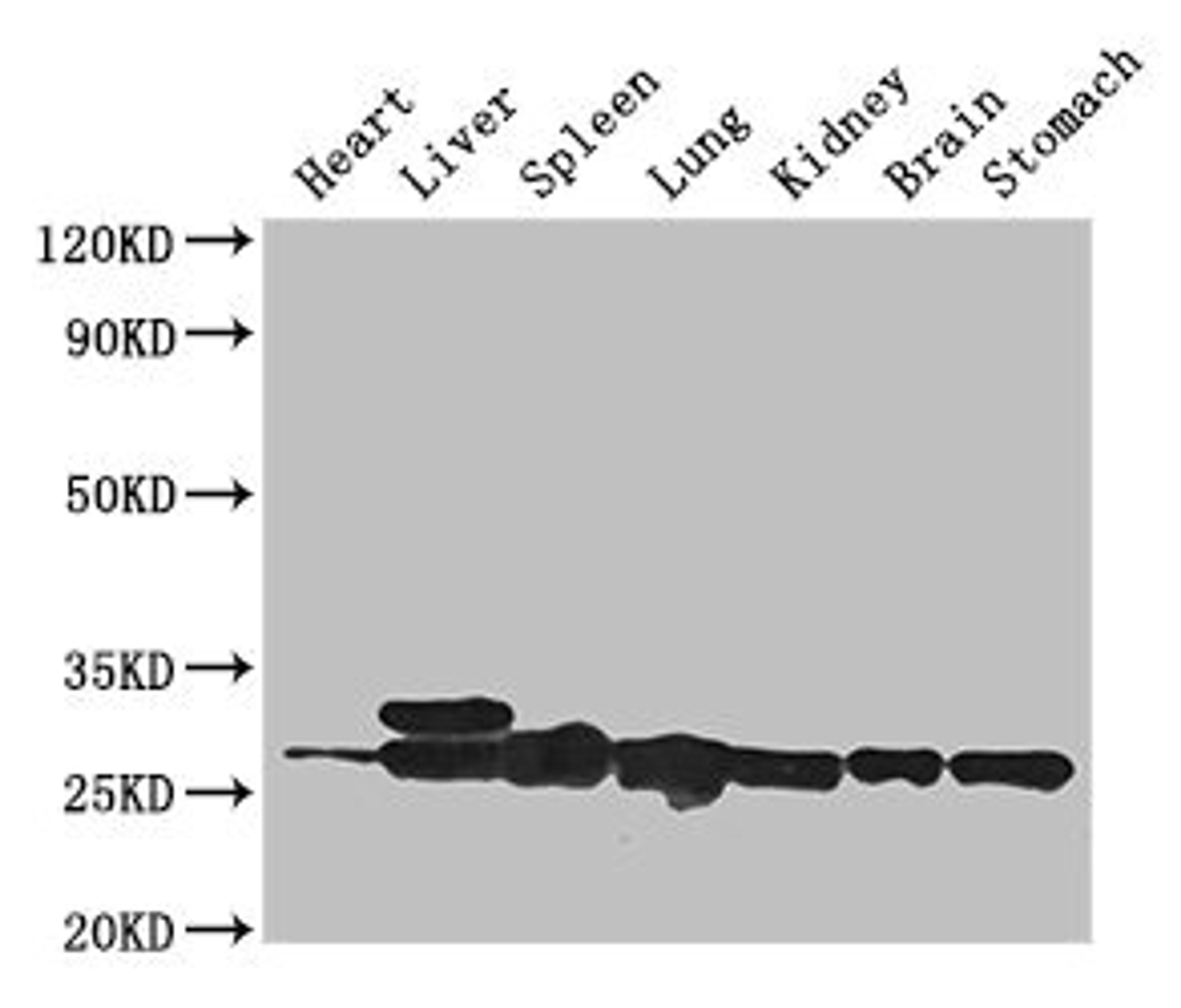 Western Blot. Positive WB detected in: Mouse heart tissue, Mouse liver tissue, Mouse spleen tissue, Mouse lung tissue, Mouse kidney tissue, Mouse brain tissue, Mouse stomach tissue. All lanes: SWI5 antibody at 3ug/ml. Secondary. Goat polyclonal to rabbit IgG at 1/50000 dilution. Predicted band size: 27 kDa. Observed band size: 27, 29 kDa. 