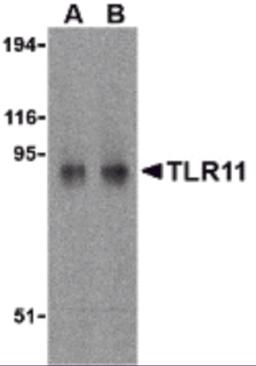 Western blot analysis of TLR11 in RAW264.7 cell lysates with TLR11 antibody at (A) 0.5 and (B) 1 &#956;g/mL. 