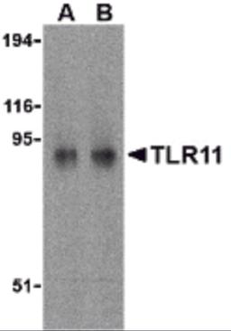 Western blot analysis of TLR11 in RAW264.7 cell lysates with TLR11 antibody at (A) 0.5 and (B) 1 μg/mL.