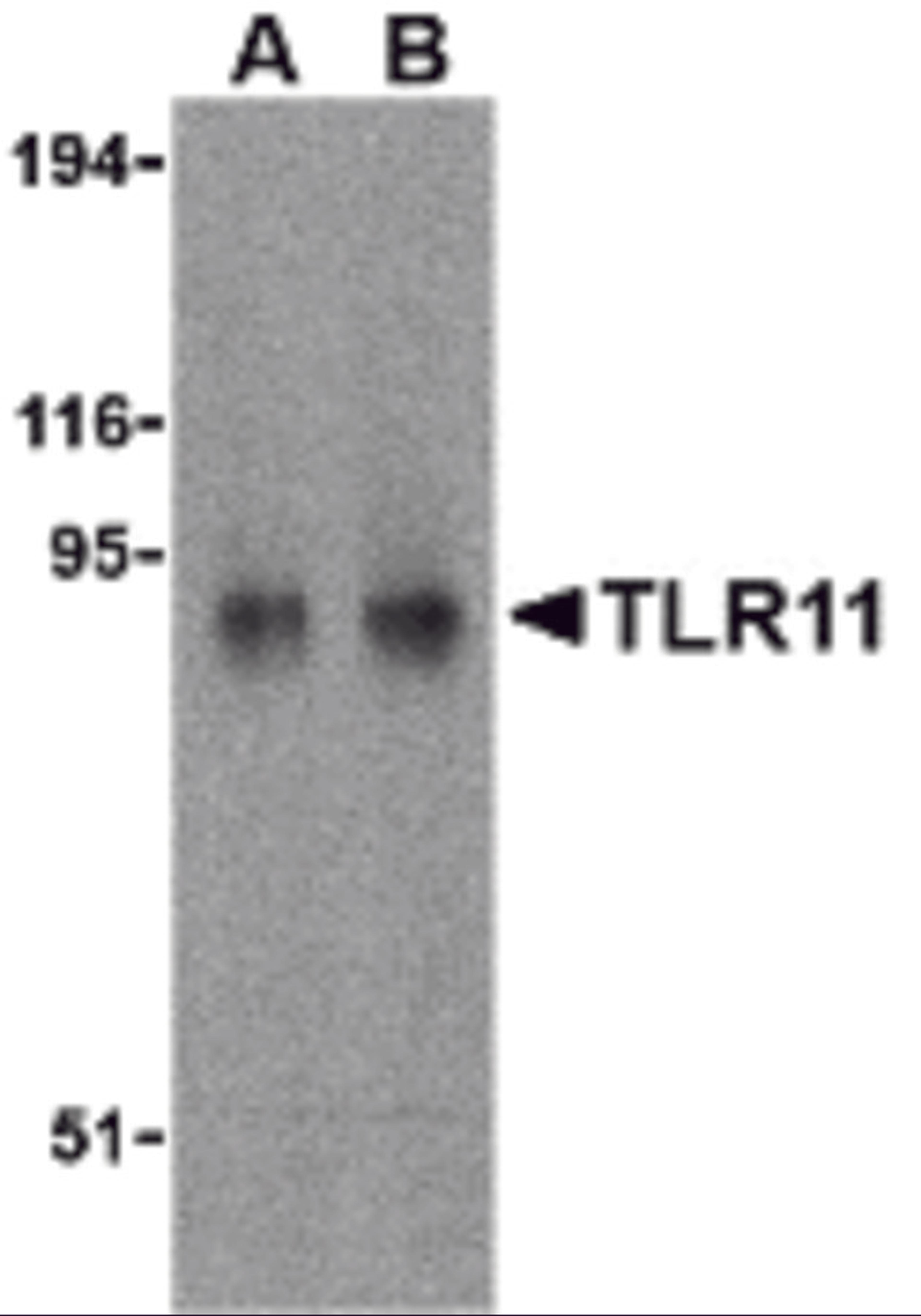 Western blot analysis of TLR11 in RAW264.7 cell lysates with TLR11 antibody at (A) 0.5 and (B) 1 μg/mL.