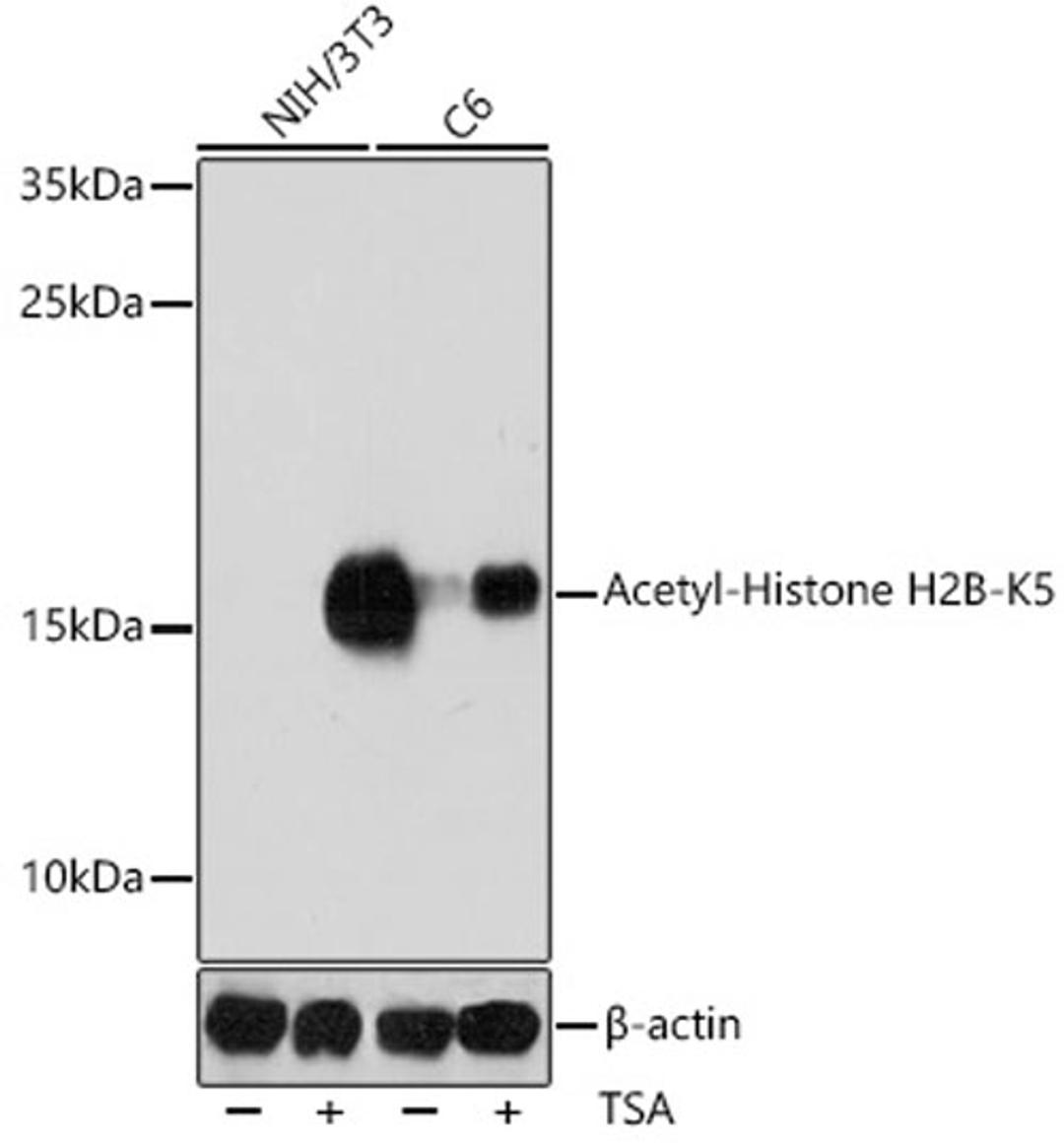 Western blot - Acetyl-Histone H2B-K5 antibody (A15621)