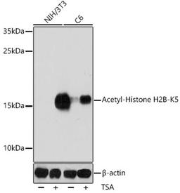 Western blot - Acetyl-Histone H2B-K5 antibody (A15621)