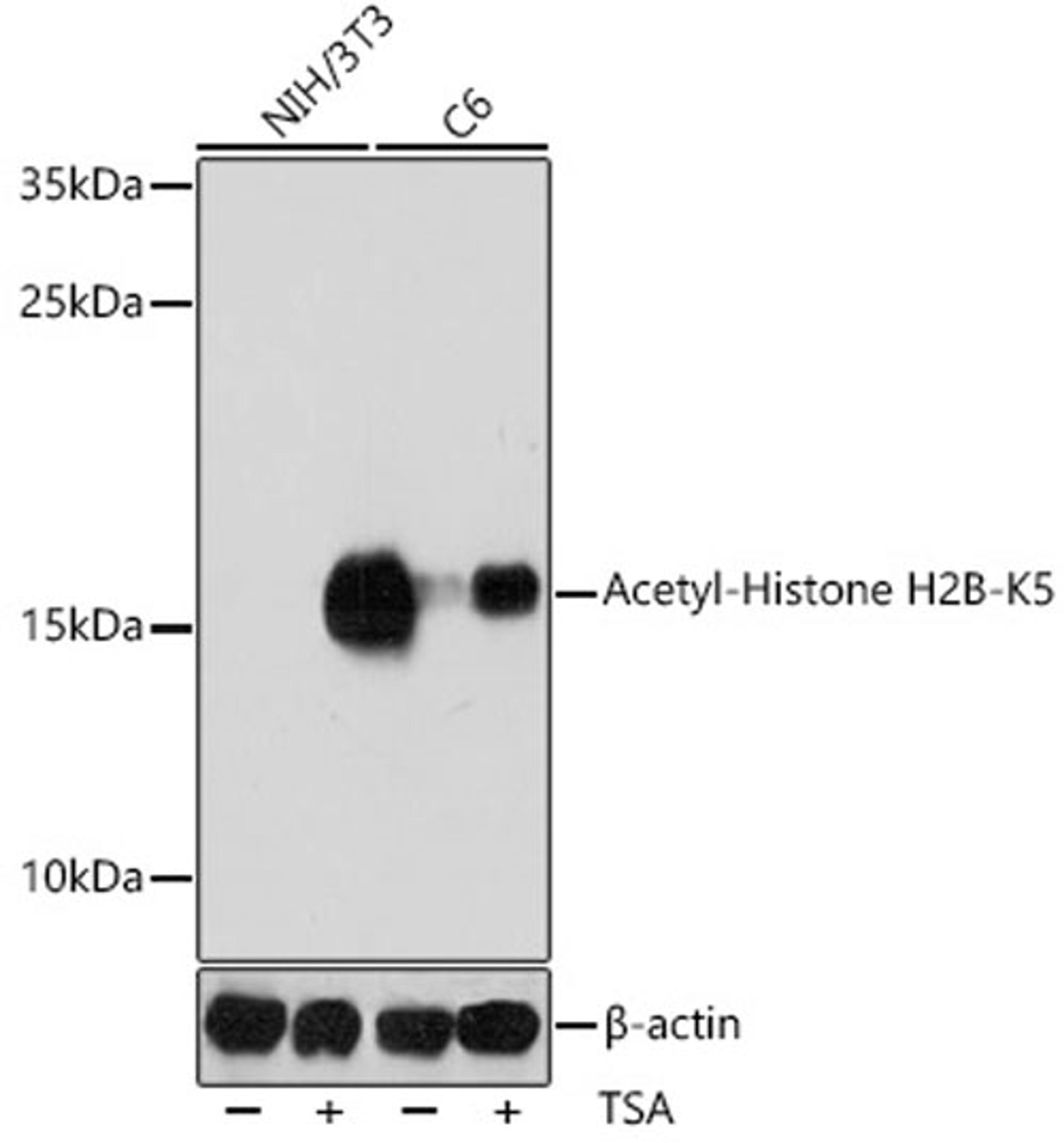 Western blot - Acetyl-Histone H2B-K5 antibody (A15621)