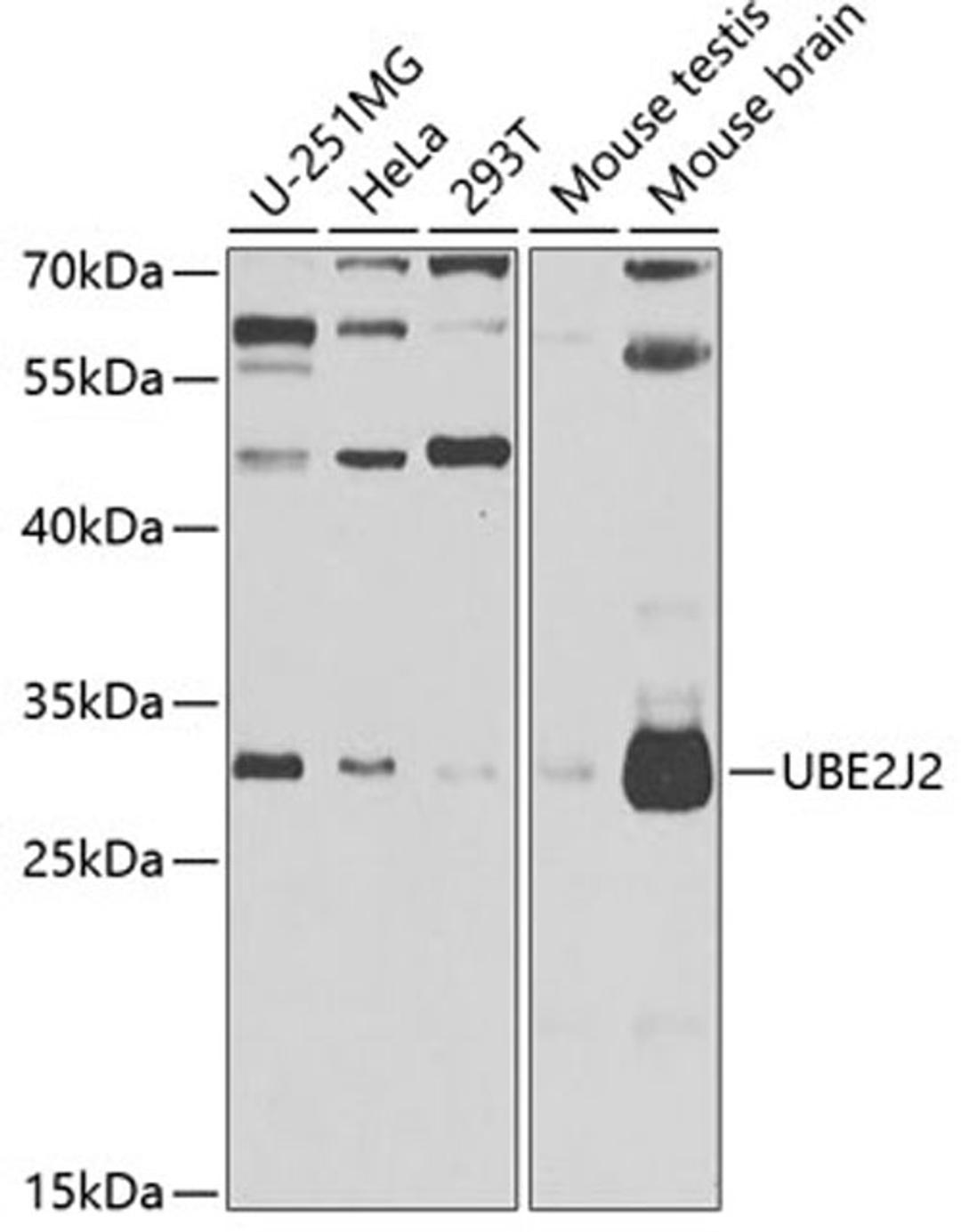 Western blot - UBE2J2 antibody (A7316)