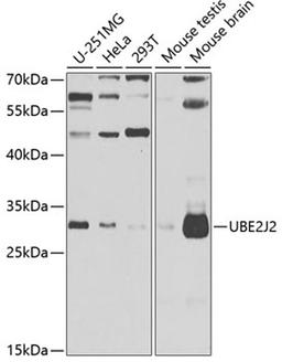 Western blot - UBE2J2 antibody (A7316)