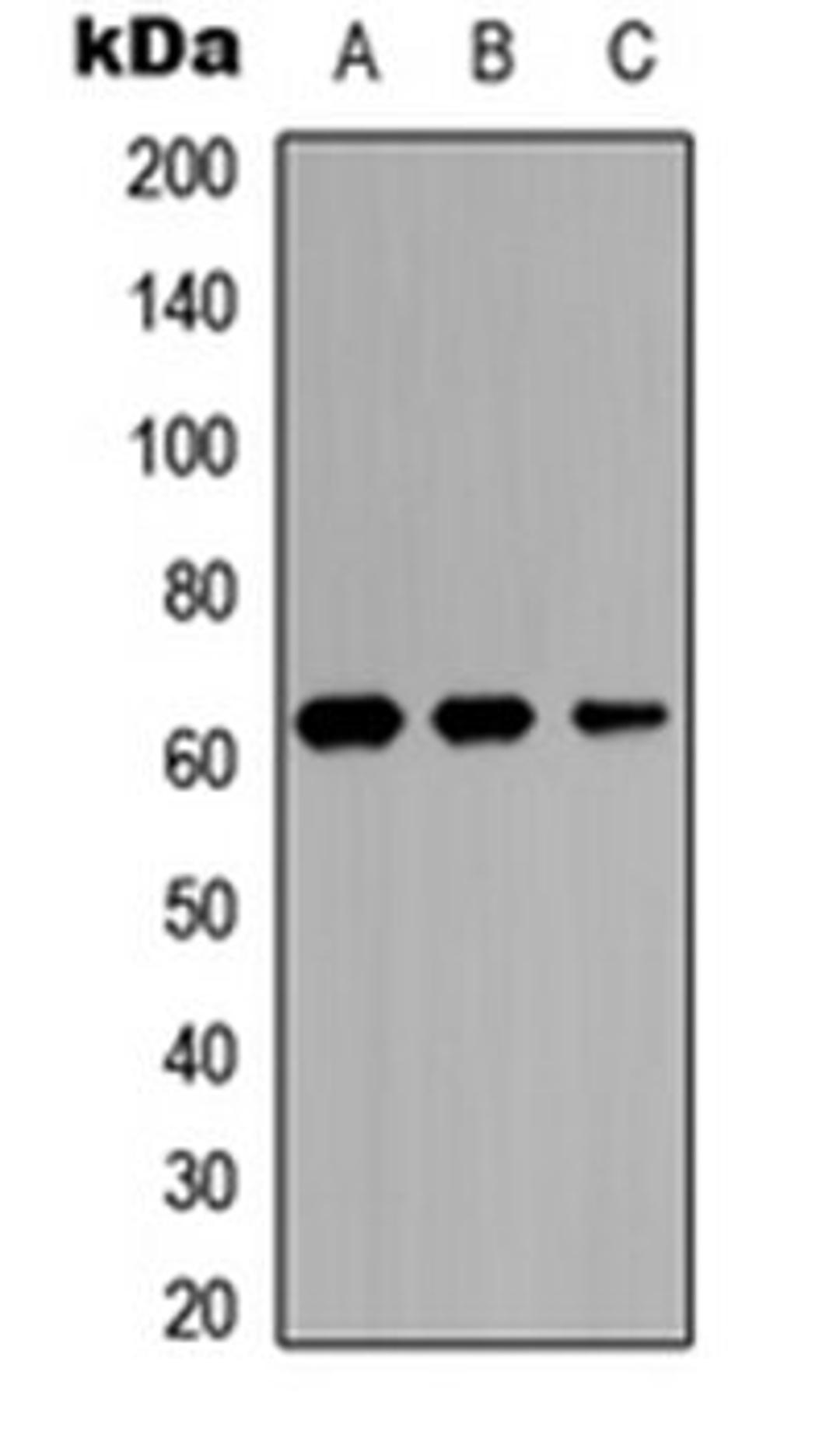 Western blot analysis of MCF7 (Lane 1), NS-1 (Lane 2), PC12 (Lane 3) whole cell lysates using IL-20RA antibody