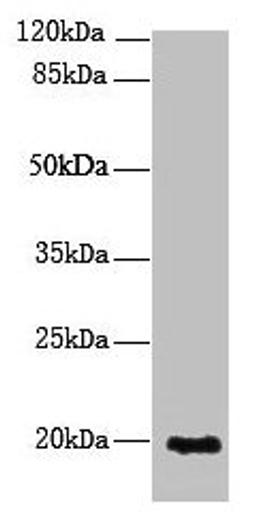 Western blot. All lanes: NUDT11 antibody at 2µg/ml + U251 whole cell lysate. Secondary. Goat polyclonal to rabbit IgG at 1/10000 dilution. Predicted band size: 19 kDa. Observed band size: 19 kDa