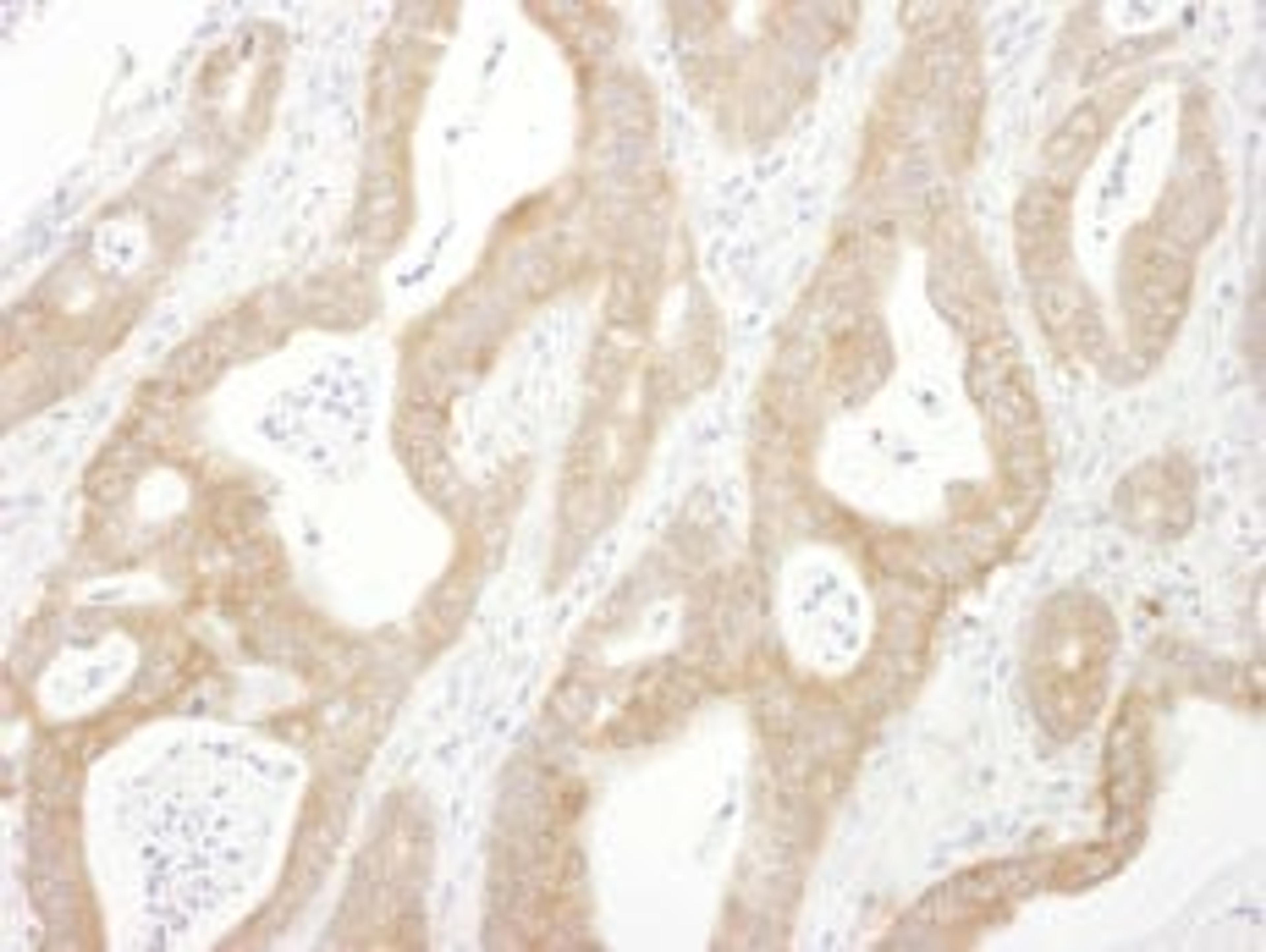 Detection of human Beta-Arrestin 1 by immunohistochemistry.