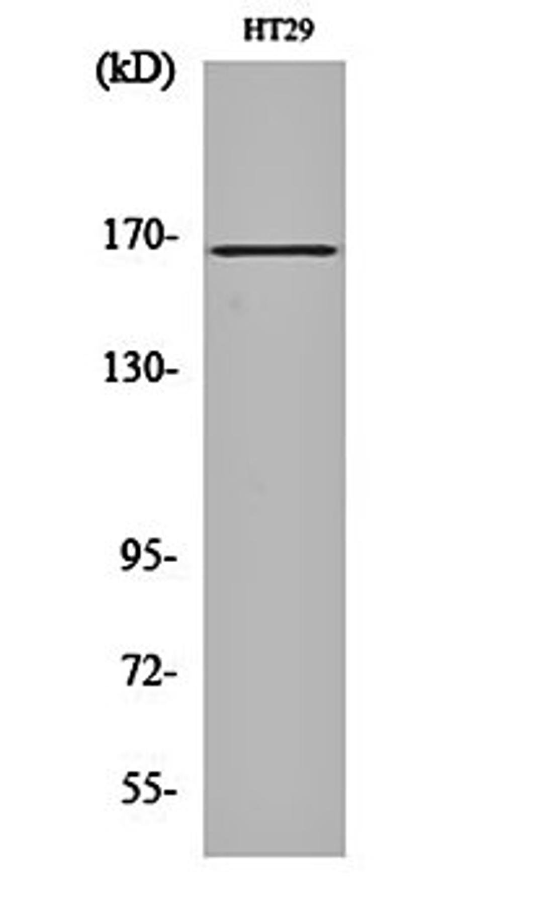 Western blot analysis of HT29 cell lysates using FANCD2 antibody