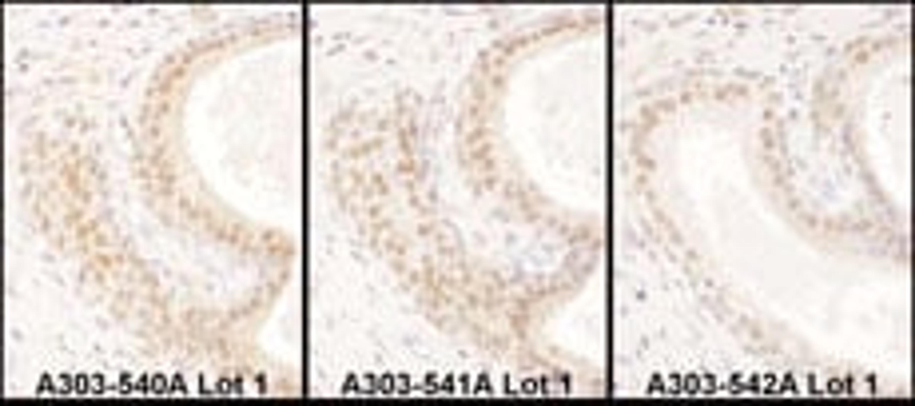 Detection of human USF2 by immunohistochemistry.