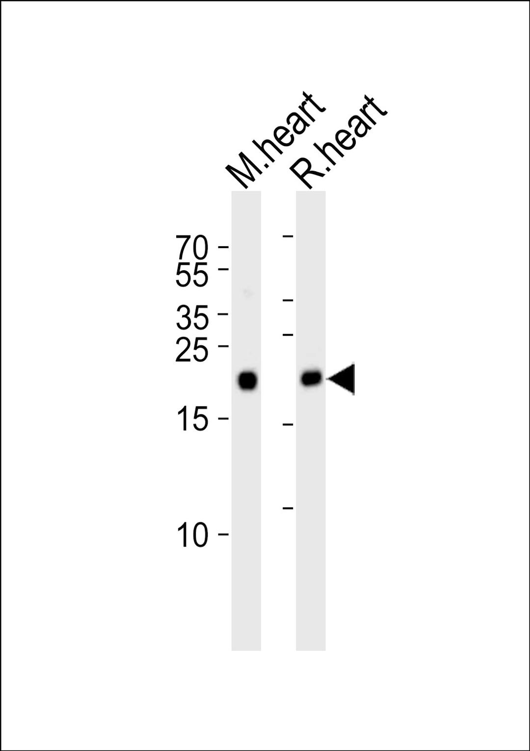 Western blot analysis of lysates from mouse heart and rat heart tissue lysate (from left to right), using PRDX2 Antibody at 1:1000 at each lane.