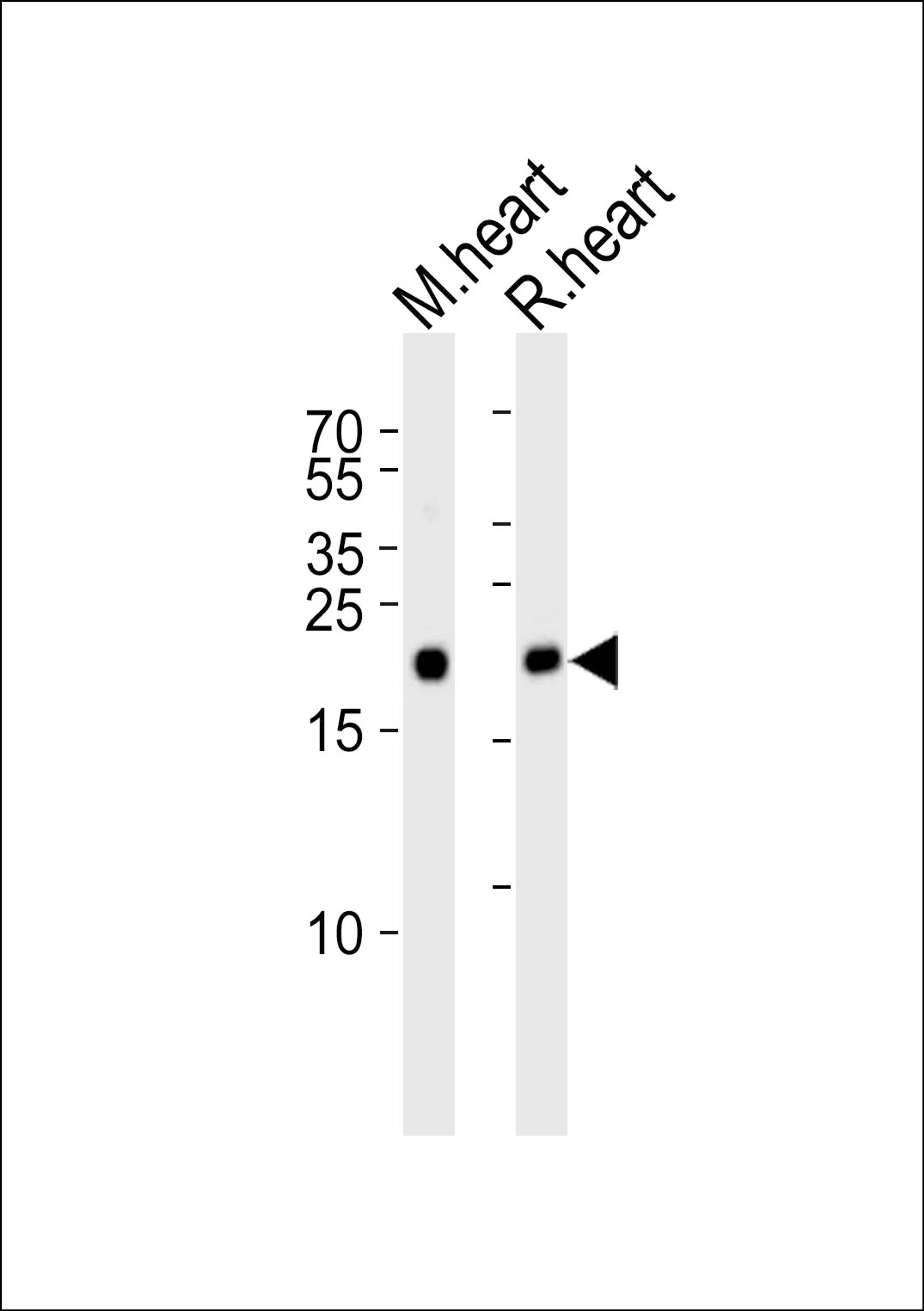 Western blot analysis of lysates from mouse heart and rat heart tissue lysate (from left to right), using PRDX2 Antibody at 1:1000 at each lane.