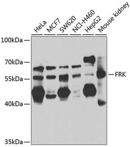 Western blot - FRK antibody (A7556)