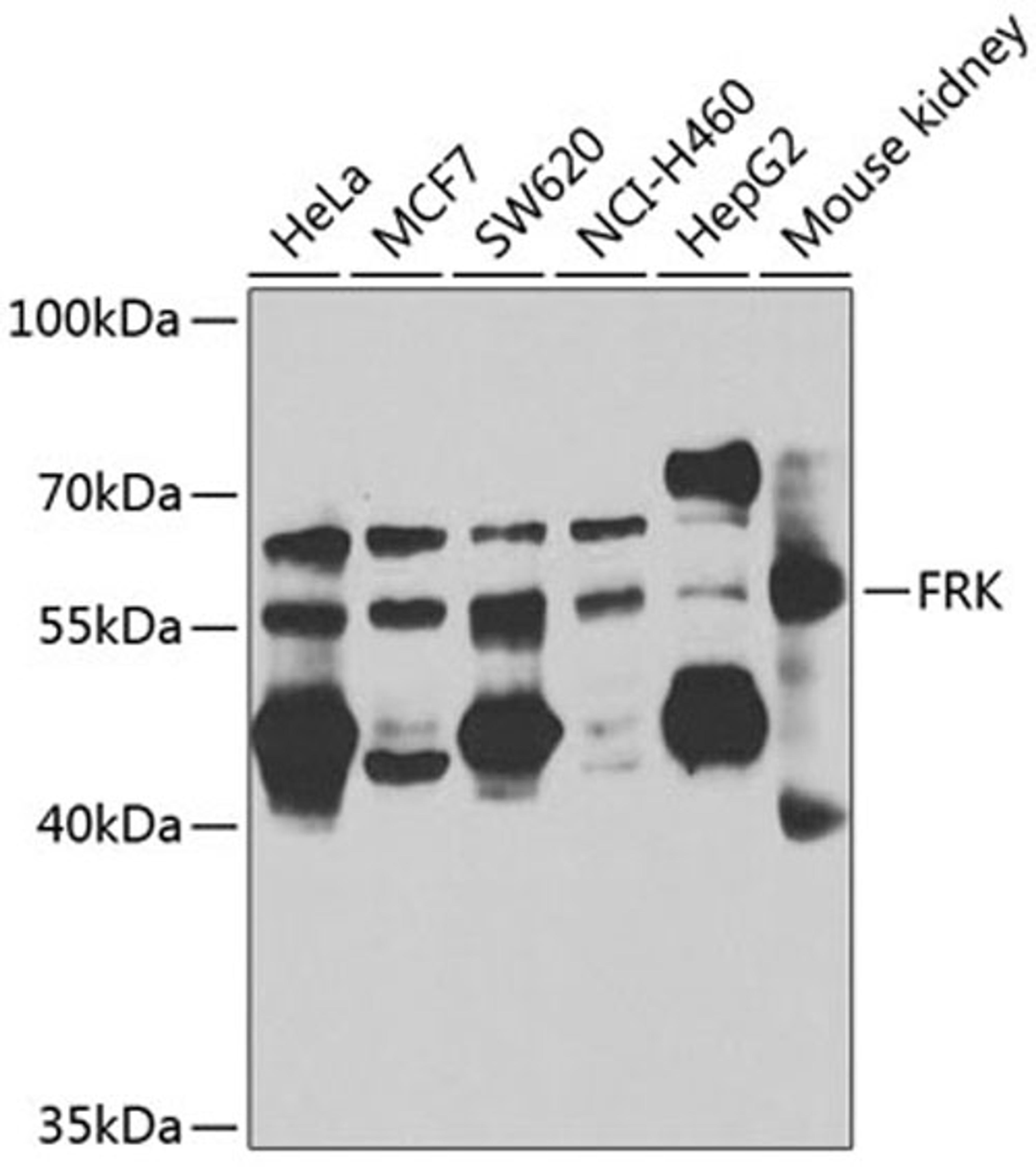 Western blot - FRK antibody (A7556)