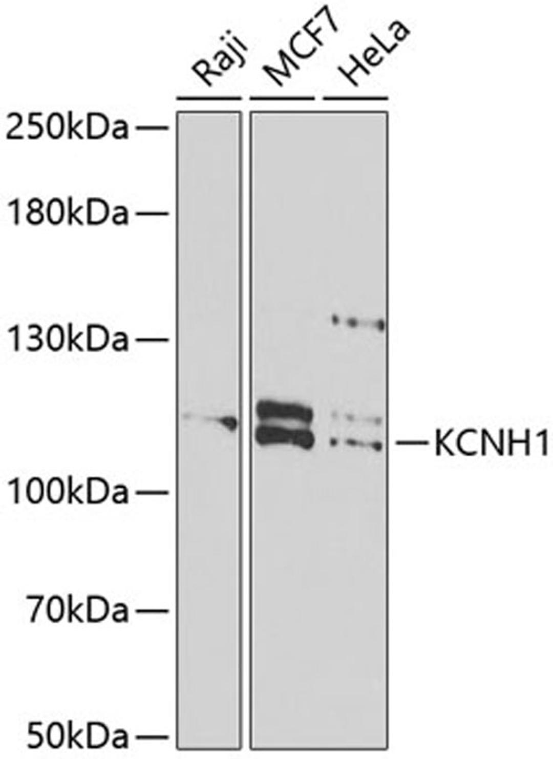 Western blot - KCNH1 antibody (A6636)