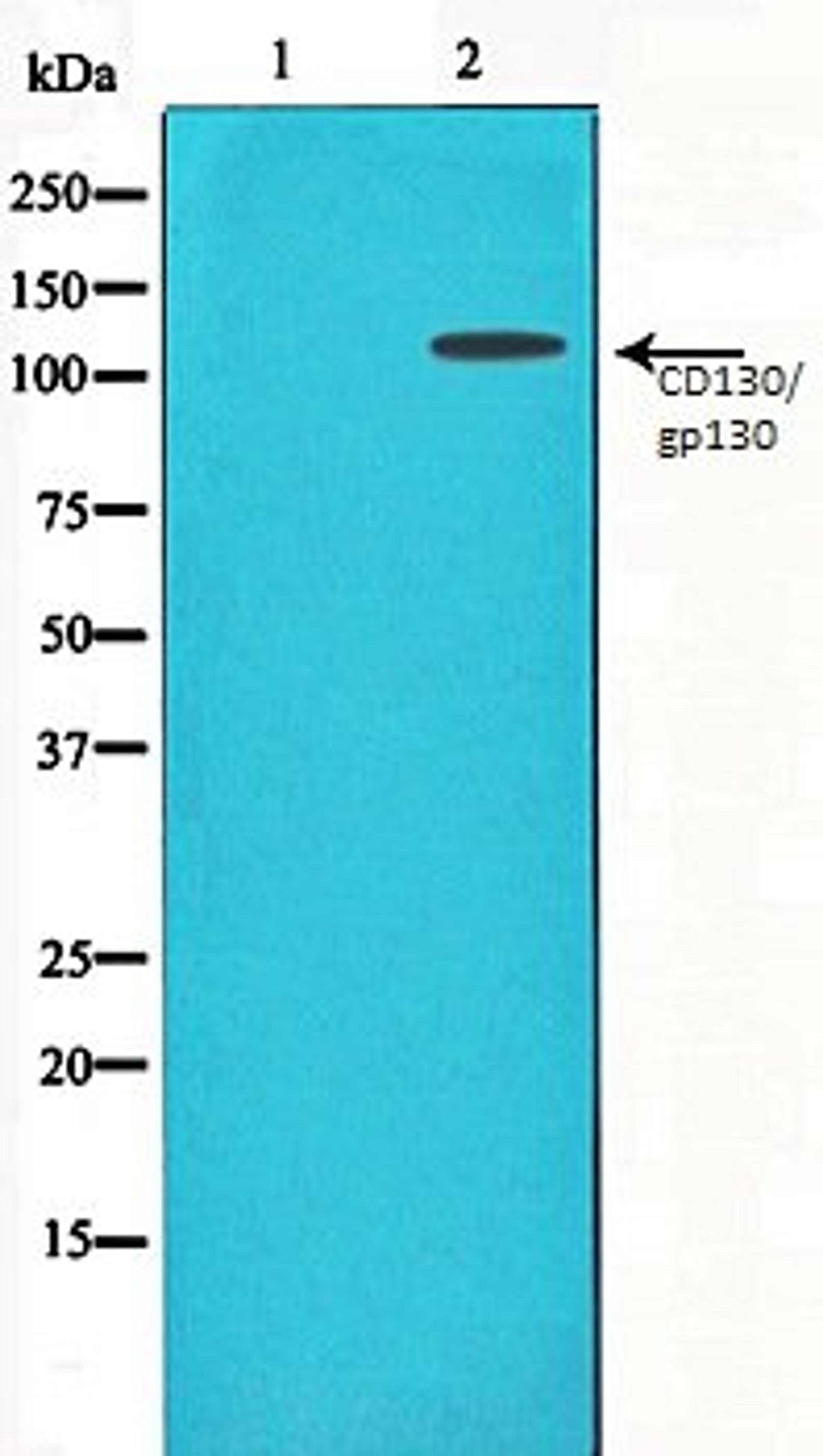 Western blot analysis of Jurkat whole cell lysates using CD130/gp130 antibody, The lane on the left is treated with the antigen-specific peptide.