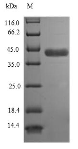 (Tris-Glycine gel) Discontinuous SDS-PAGE (reduced) with 5% enrichment gel and 15% separation gel.