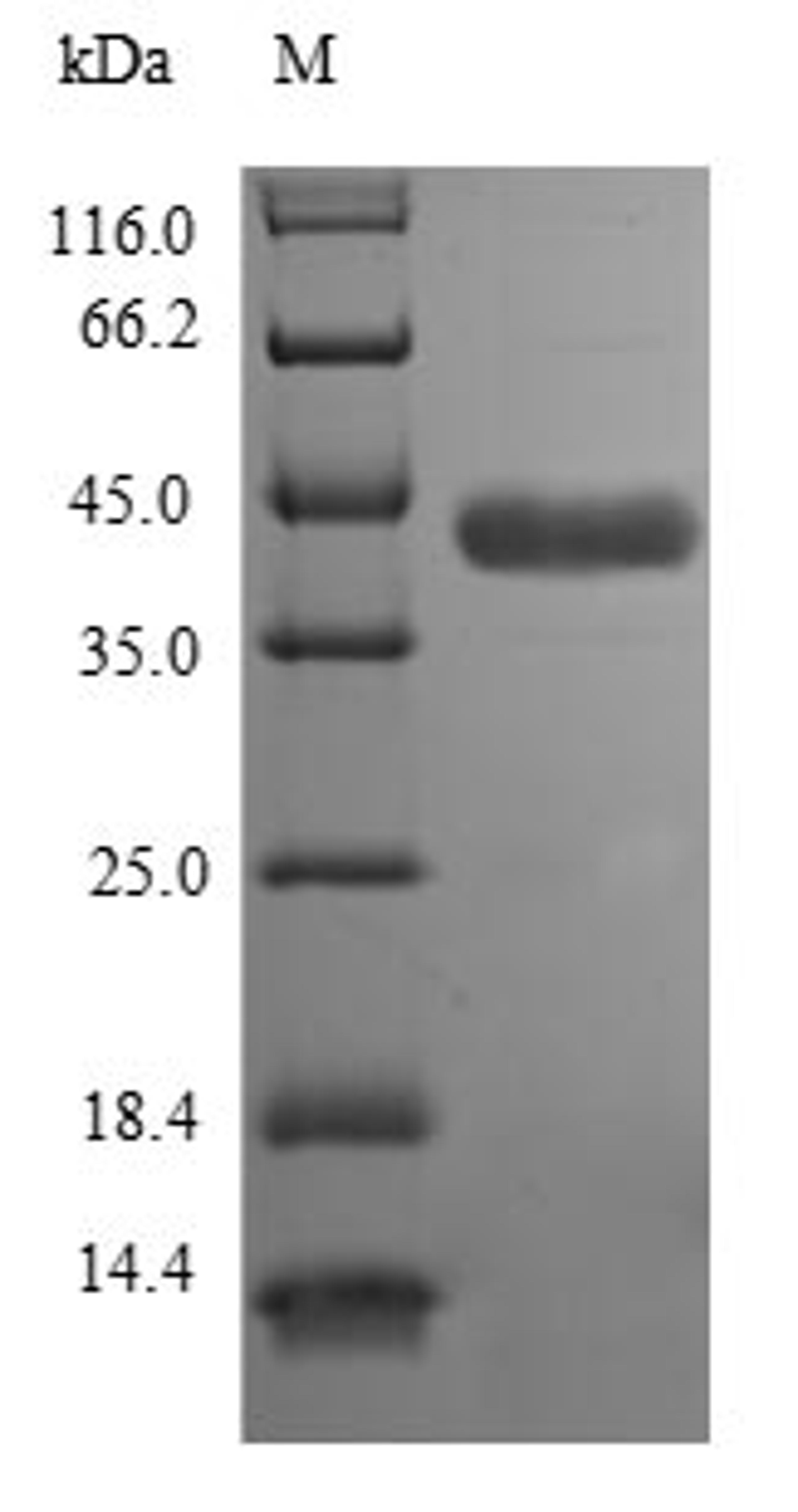 (Tris-Glycine gel) Discontinuous SDS-PAGE (reduced) with 5% enrichment gel and 15% separation gel.