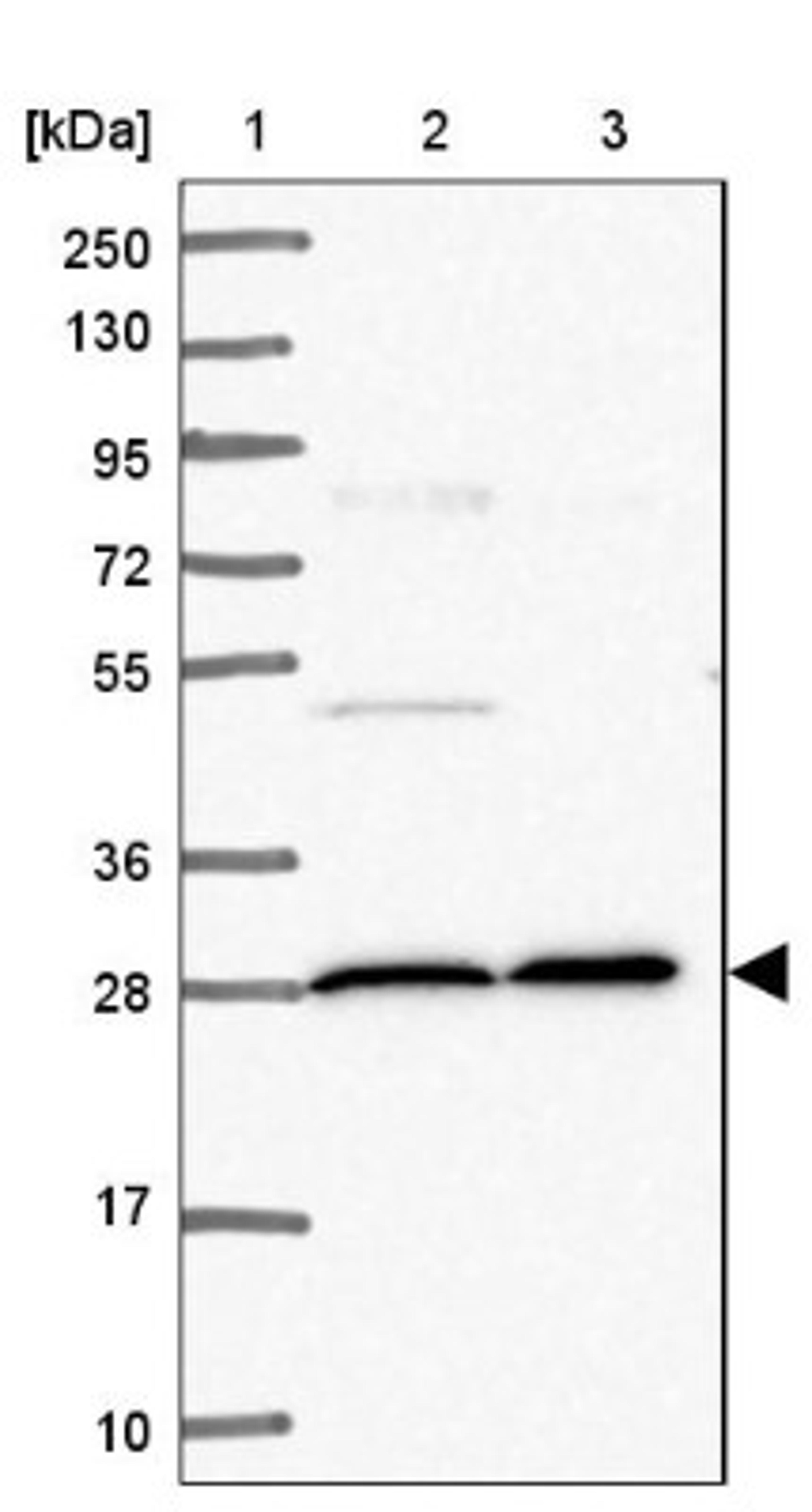 Western Blot: EID1 Antibody [NBP2-47474] - Lane 1: Marker [kDa] 250, 130, 95, 72, 55, 36, 28, 17, 10.  Lane 2: Human cell line RT-4.  Lane 3: Human cell line U-251MG.