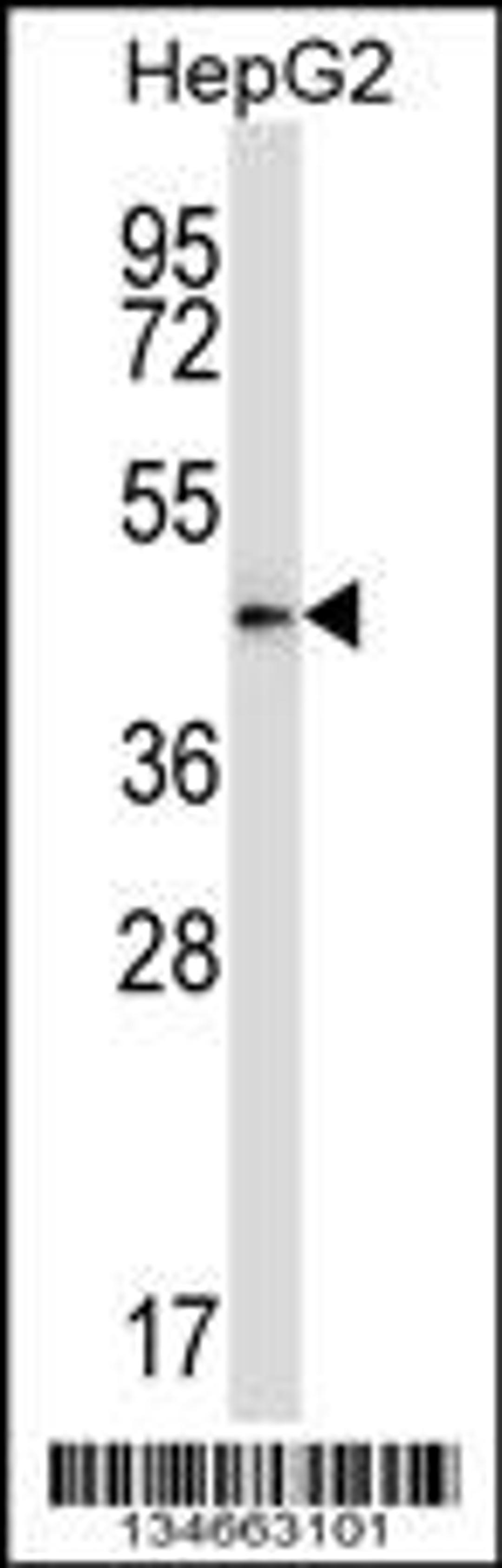 Western blot analysis in HepG2 cell line lysates (35ug/lane).