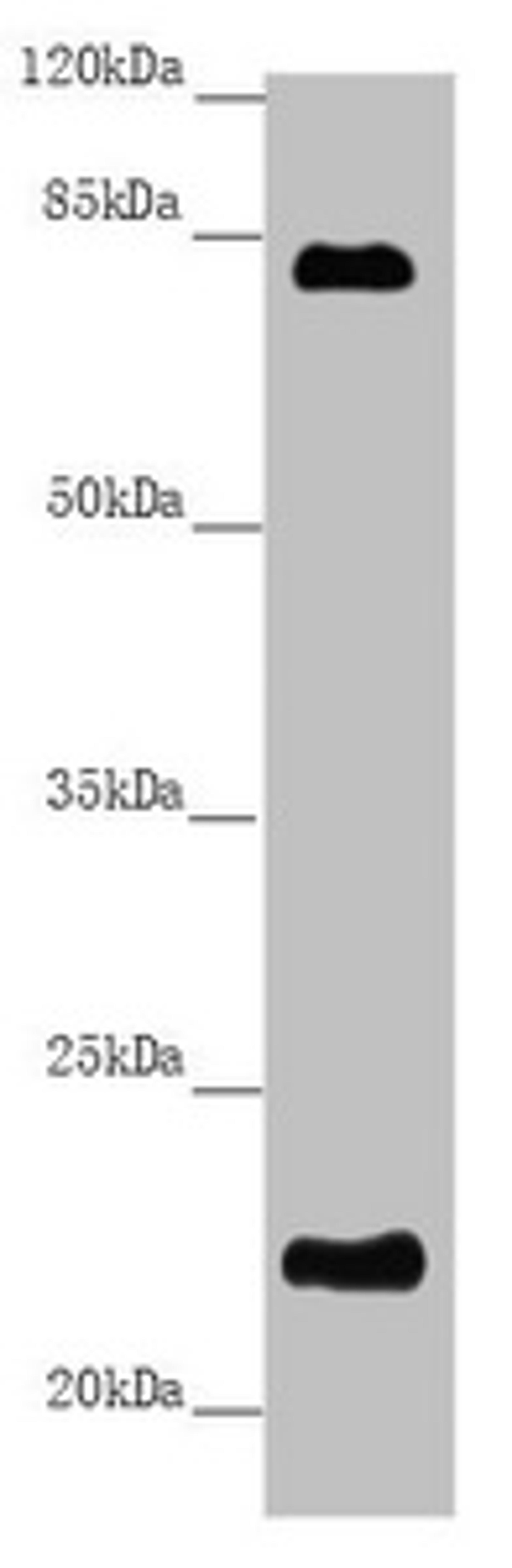 Western blot. All lanes: REEP1 antibody at 5.84 ug/ml + Mouse gonadal tissue. Secondary. Goat polyclonal to rabbit IgG at 1/10000 dilution. Predicted band size: 23, 19, 17 kDa. Observed band size: 23, 80 kDa.