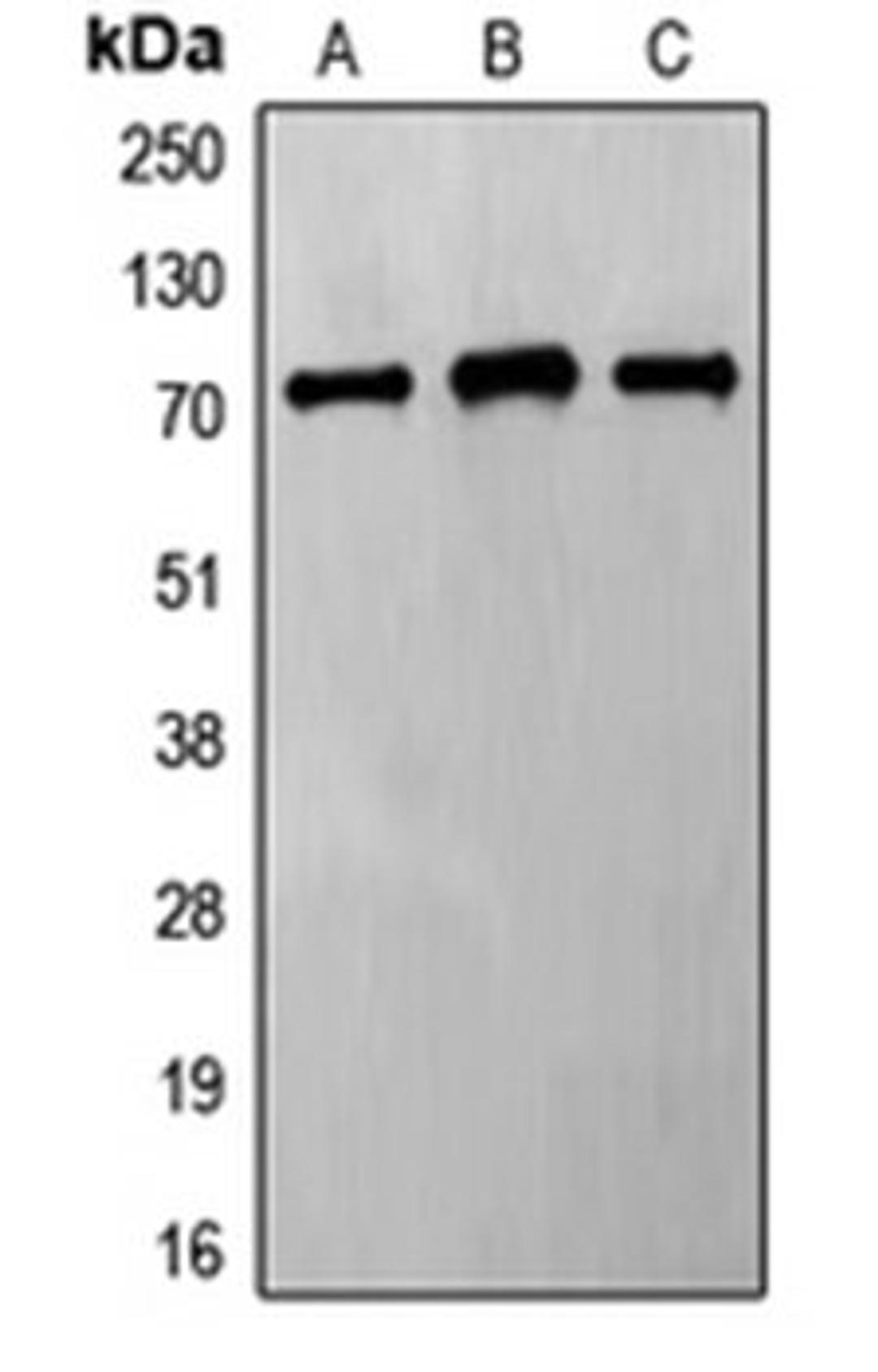 Western blot analysis of HeLa (Lane 1), Jurkat (Lane 2), MCF7 (Lane 3) whole cell lysates using FZD8 antibody